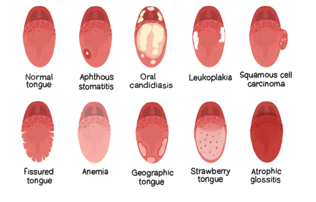 What Is Oral Pathology in Dentistry