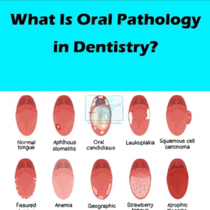 What Is Oral Pathology in Dentistry? A Complete Student Guide
